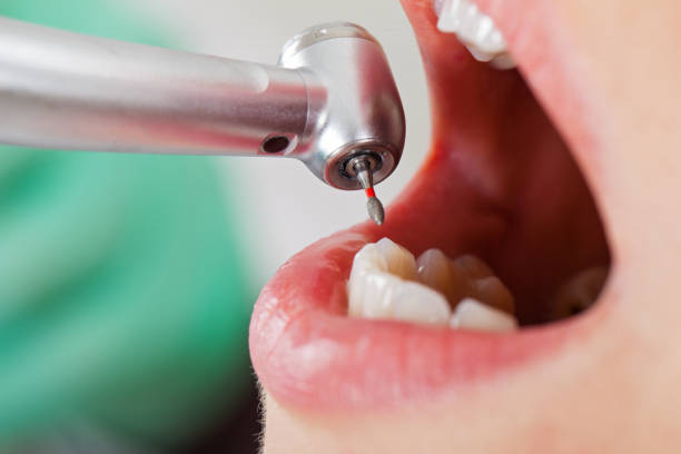 Best Urgent Tooth Repair  in Takoma Park, MD